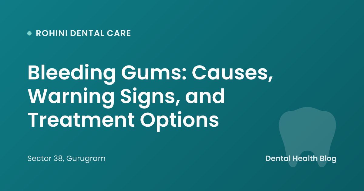 Bleeding Gums: Causes, Warning Signs, and Treatment Options