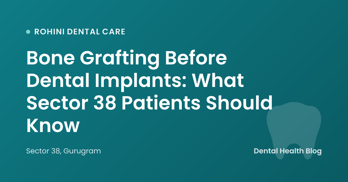 Bone Grafting Before Dental Implants: What Sector 38 Patients Should Know