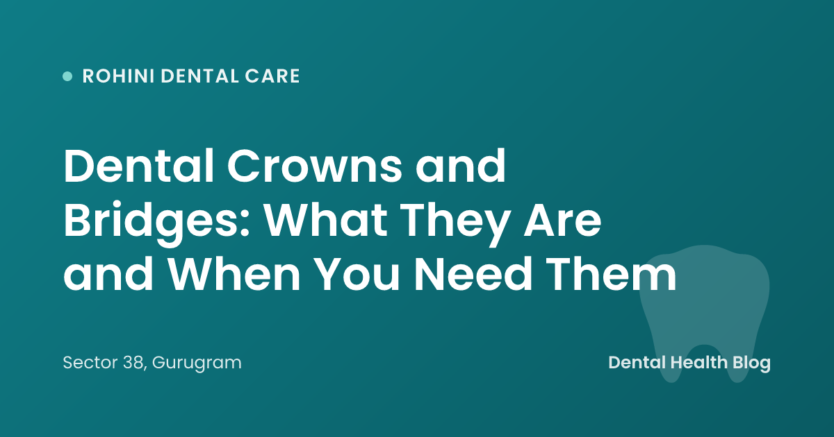 Dental Crowns and Bridges: What They Are and When You Need Them