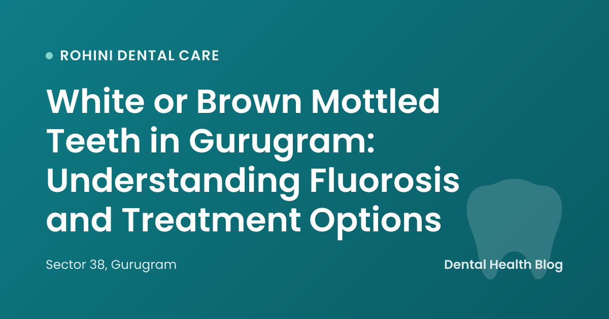 White or Brown Mottled Teeth in Gurugram: Understanding Fluorosis and Treatment Options