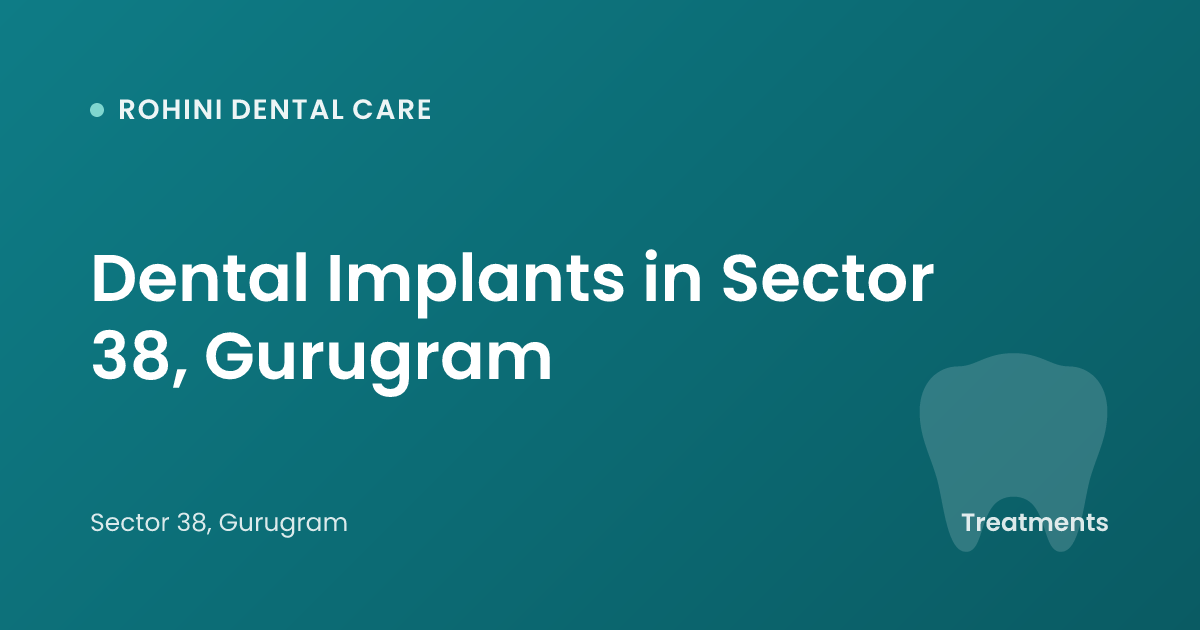 Dental Implants in Sector 38, Gurugram