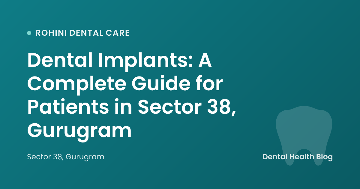 Dental Implants: A Complete Guide for Patients in Sector 38, Gurugram