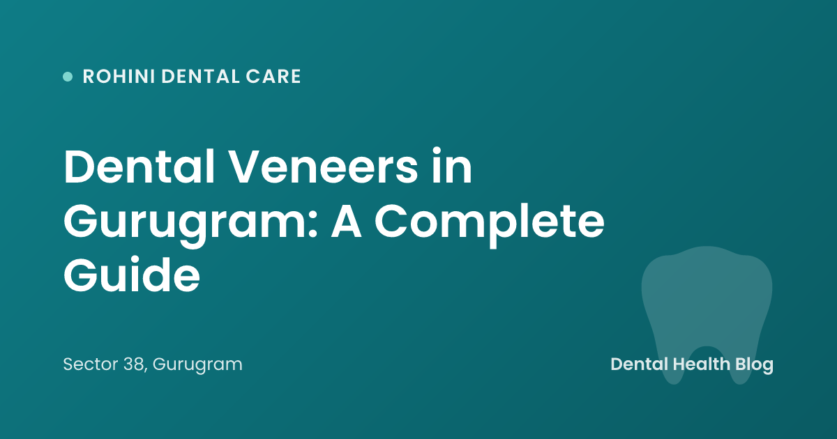 Dental Veneers in Gurugram: A Complete Guide