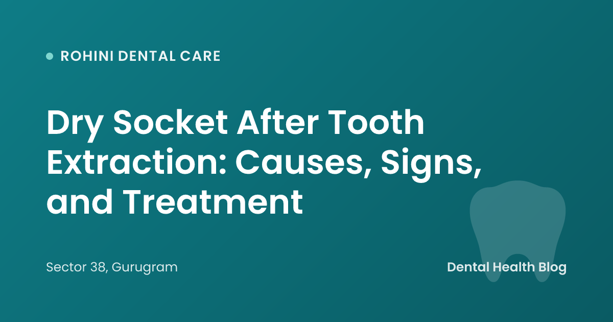 Dry Socket After Tooth Extraction: Causes, Signs, and Treatment