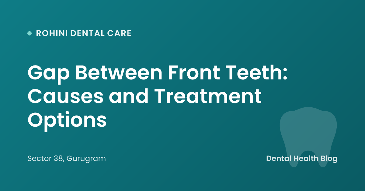 Gap Between Front Teeth: Causes and Treatment Options