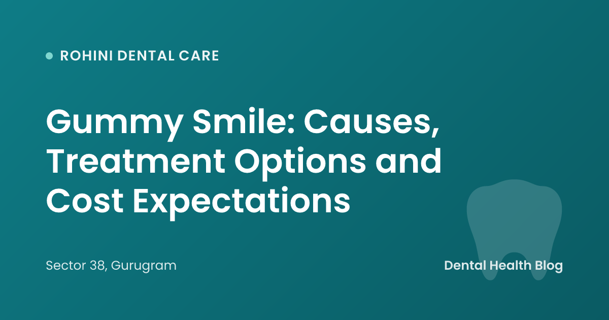 Gummy Smile: Causes, Treatment Options and Cost Expectations