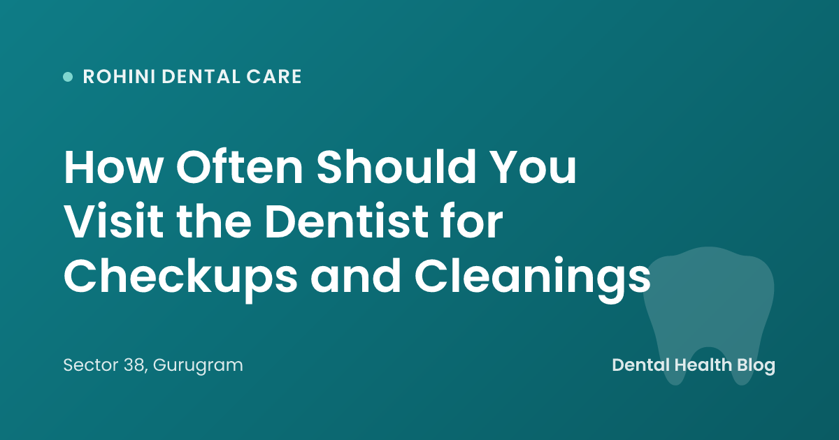 How Often Should You Visit the Dentist for Checkups and Cleanings