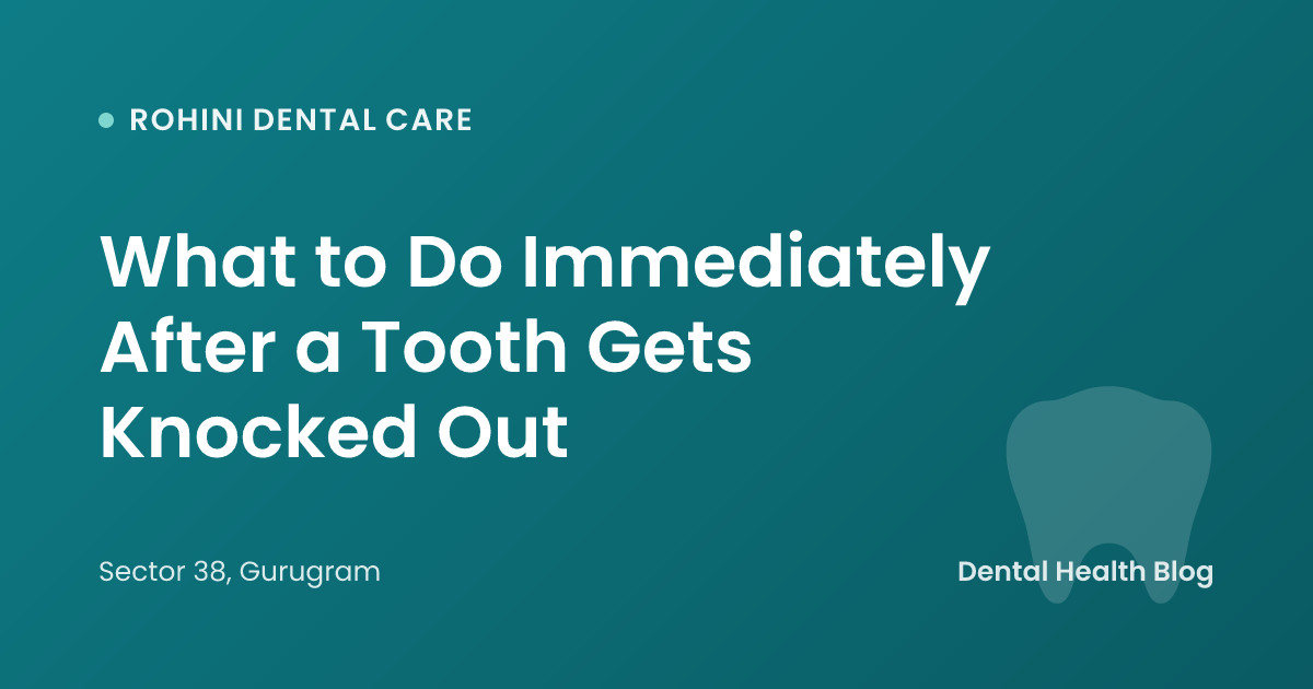 What to Do Immediately After a Tooth Gets Knocked Out
