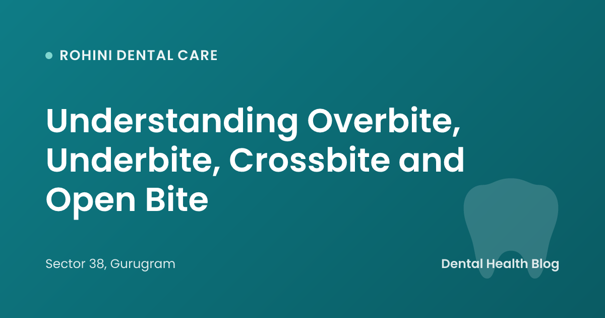 Understanding Overbite, Underbite, Crossbite and Open Bite