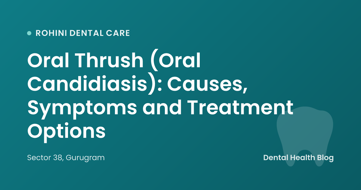 Oral Thrush (Oral Candidiasis): Causes, Symptoms and Treatment Options