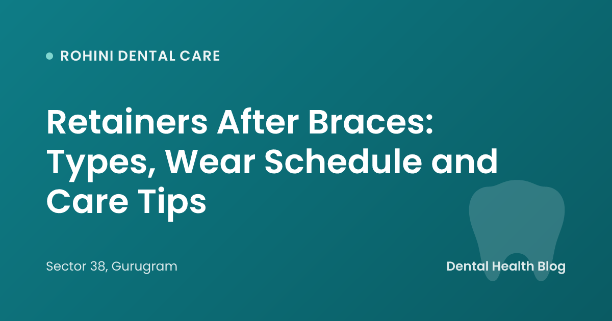 Retainers After Braces: Types, Wear Schedule and Care Tips