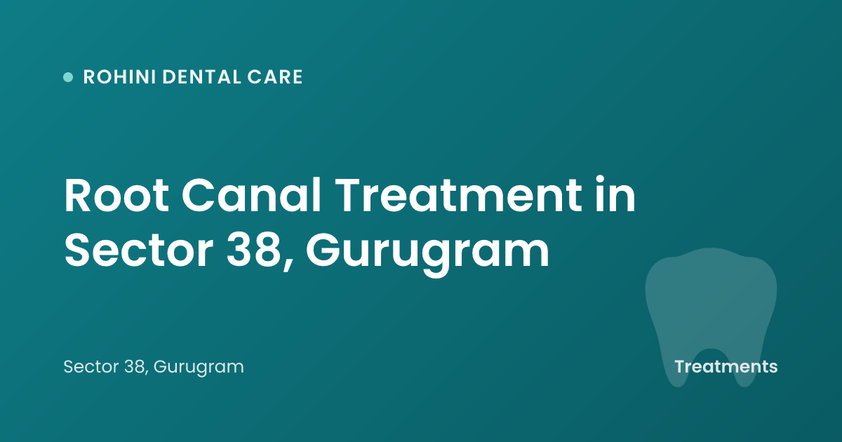 Root Canal Treatment in Sector 38, Gurugram