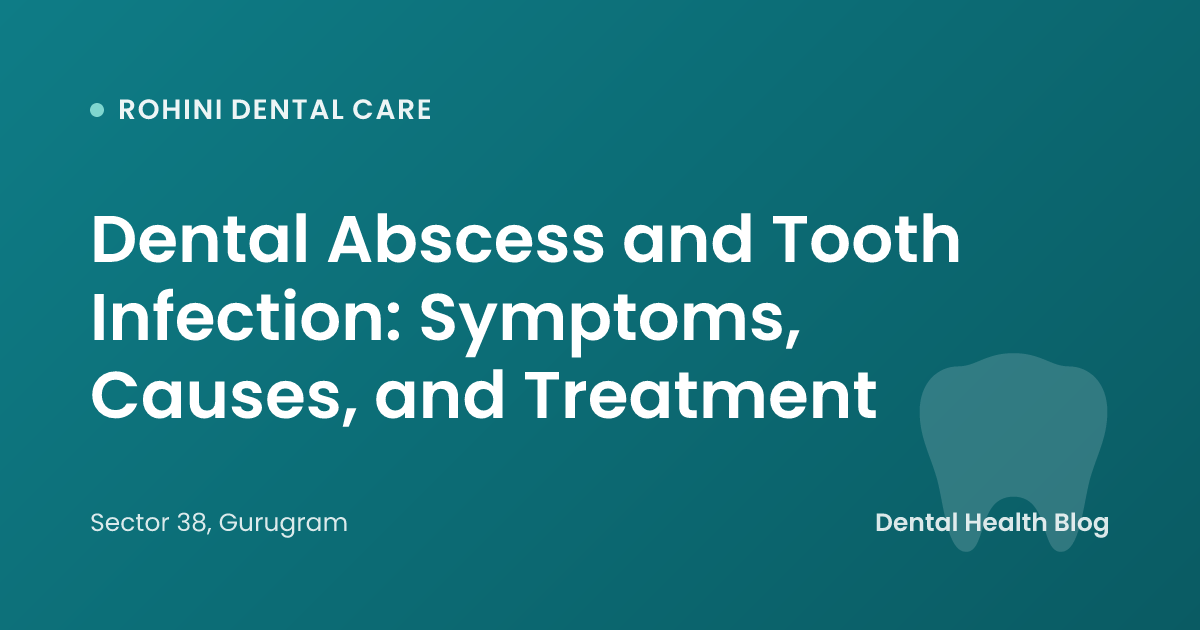 Dental Abscess and Tooth Infection: Symptoms, Causes, and Treatment