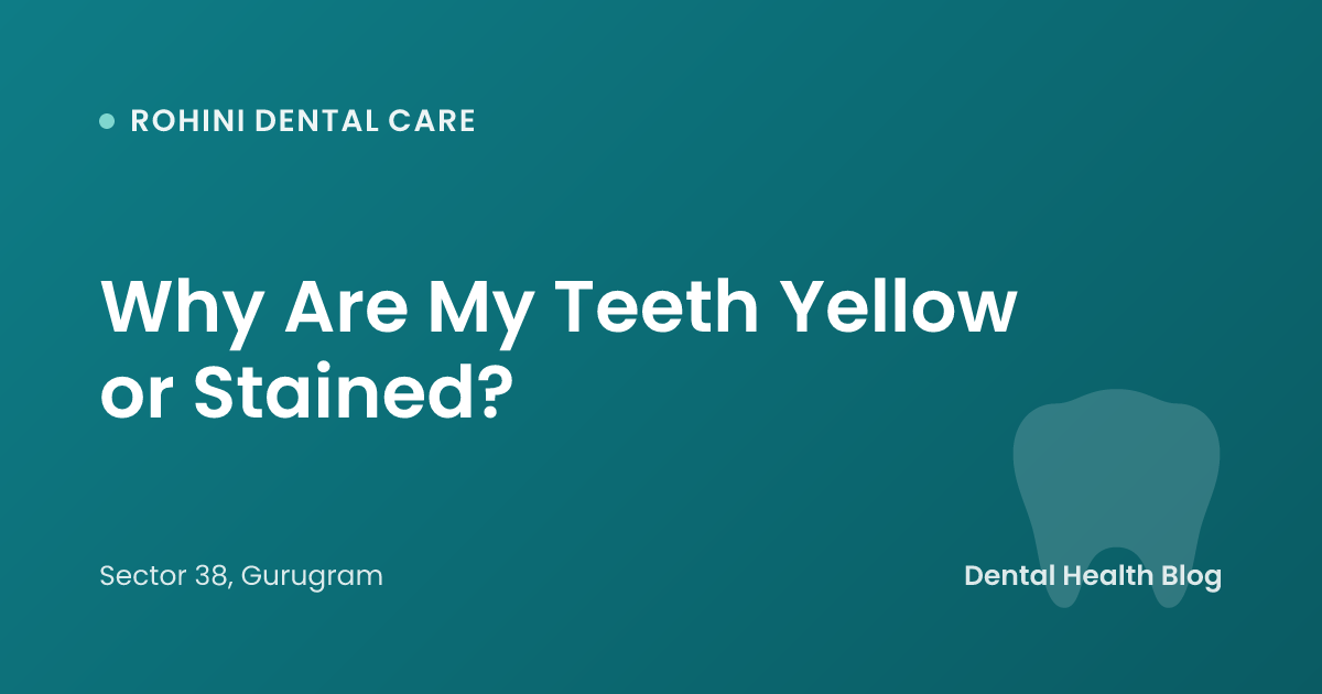 Why Are My Teeth Yellow or Stained?