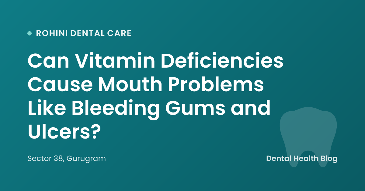 Can Vitamin Deficiencies Cause Mouth Problems Like Bleeding Gums and Ulcers?